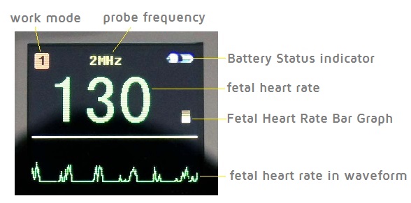 fetal doppler ireland